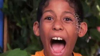 刺猬搞笑视频下载,笑料横生，欢乐无限下载攻略